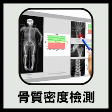 骨質密度檢測